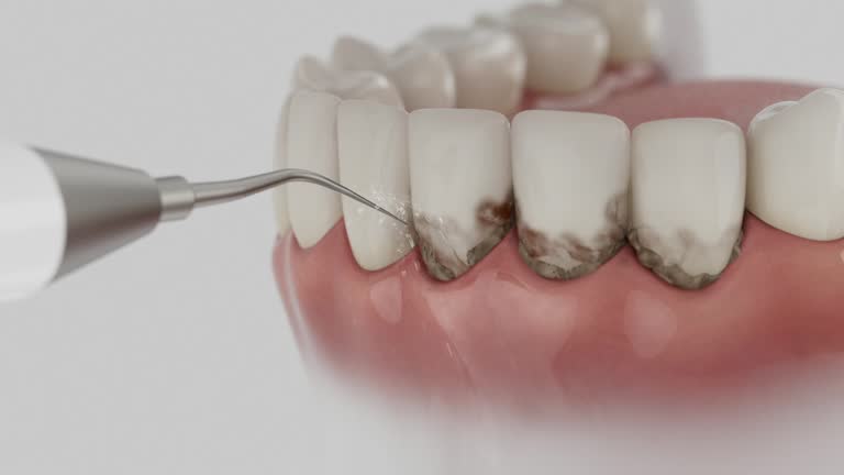 Reliable Dental contractor in Hunter, OH by Dentist Open Now